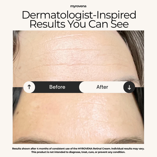 MYROVENA™ - 1% Retinal Liposome Cream + Fermented Rice