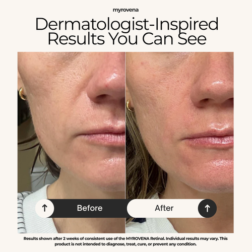 MYROVENA™ - 1% Retinal Liposome Cream + Fermented Rice