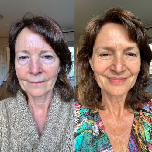 MYROVENA™ - 4% Retinal Liposome Anti Wrinkle Cream