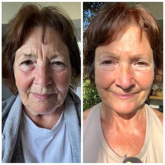 MYROVENA™ - 4% Retinal Liposome Anti Wrinkle Cream