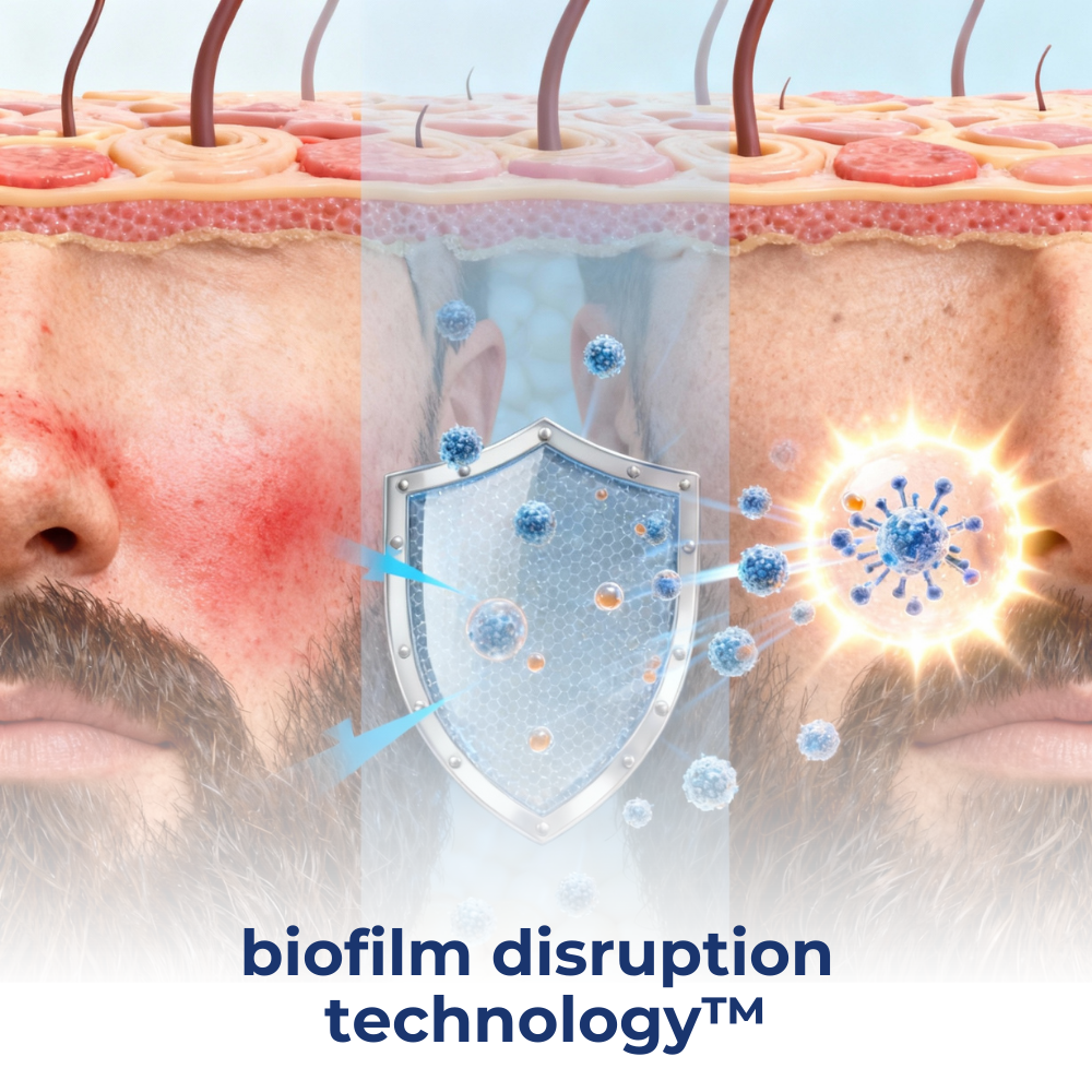 Eliminate Flakes & Itching