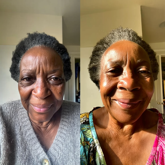 MYROVENA™ - 4% Retinal Liposome Anti Wrinkle Cream